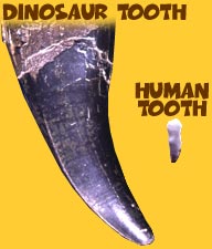 Dinosaur and human teeth